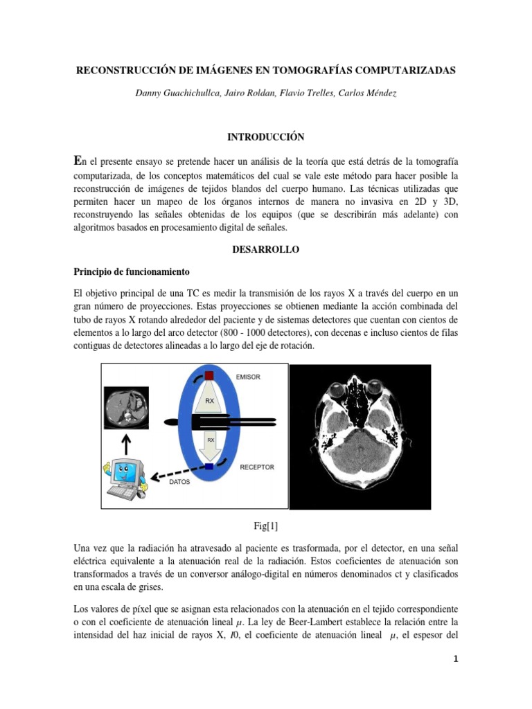 Reconstrucción de Imágenes Tomografías | PDF | Ct Scan | Rayo X