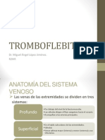 Tromboflebitis