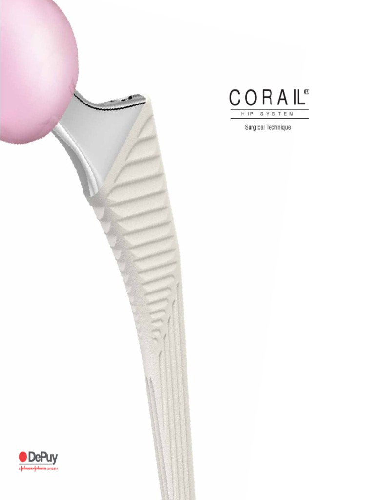 CORAIL ST Surgical Technique and Instrumentation (DePuy) | PDF | Hip ...