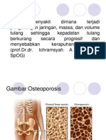 166959475-osteoporosi-ppt