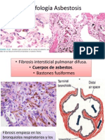 Morfología Asbestosis