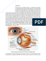 Glaucoma Essay