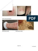 2 Teh Nursing - Plagi Prin Muscare - Poze PDF