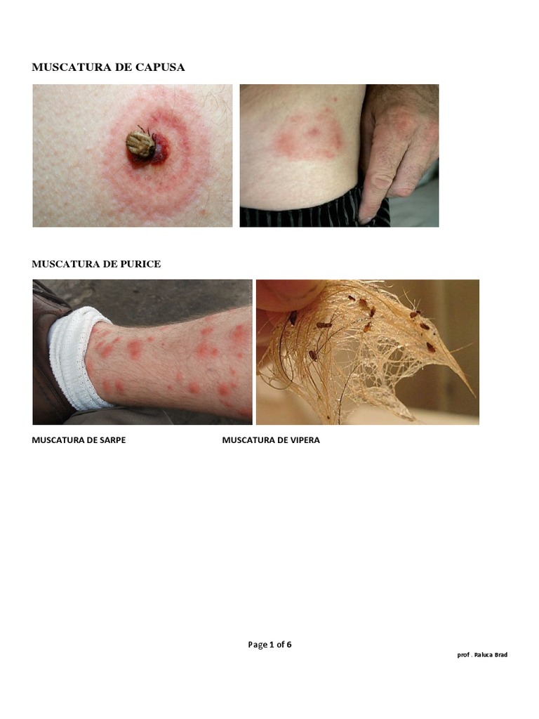 2 Teh Nursing - Plagi Prin Muscare - Poze PDF  PDF