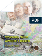 What Really Causes Alzheimers by Harold Foster