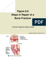 Steps in Repair of A Bone Fracture: Process Diagrams Step-by-Step