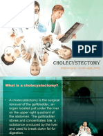 Cholecystectomy