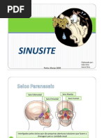 sinusite
