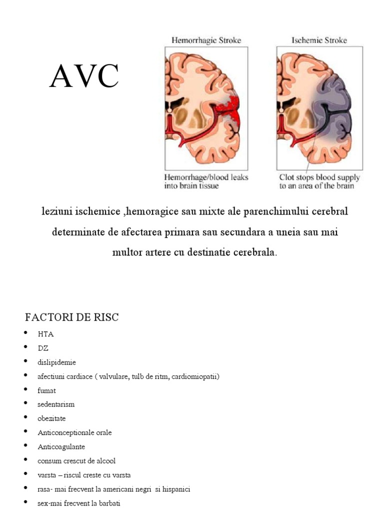 Avc | PDF