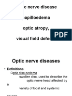 Optic Nerve Disease, Papillaedema Optic Atropy, Visual Field