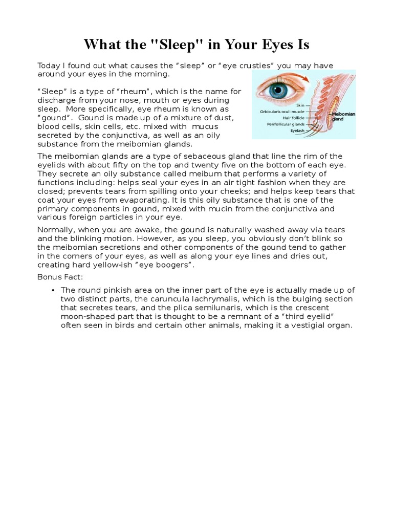 What The Sleep in Your Eyes Is | PDF