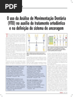 Vto e Sistemas de Ancoragem