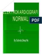 EKG Normal (Compatibility Mode)