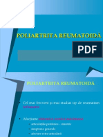 Poliartrita reumatoida