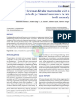 Report Case - Conjoined Primery Molar and Premolar