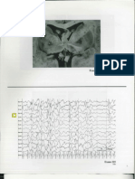 Neurology Rite 2011 Pictures With Explanations