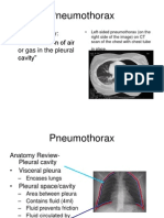  Pneumothorax