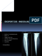 Ekspertise Radiologi Fraktur Dian Bismillah
