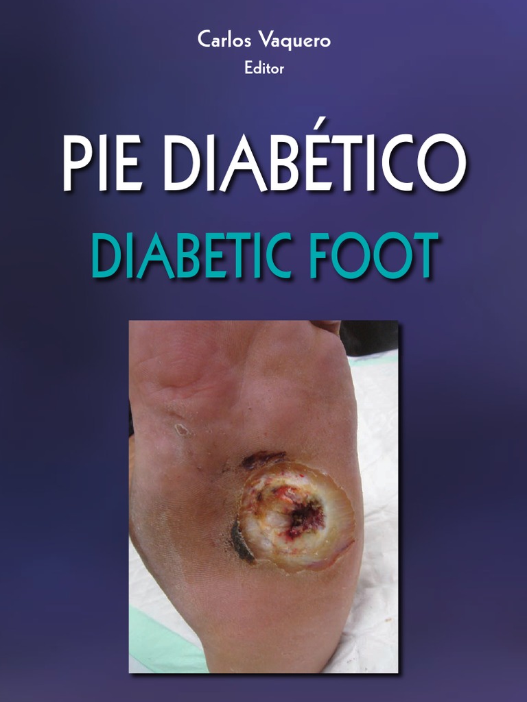 Pie Diabetico Antibióticos Diabetes mellitus Prueba gratuita de