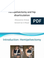 Hemipelvectomy and Hip Disarticulation