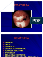 Hematuria