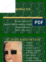 Rosacea Guide for Diagnosis, Stages and Treatment