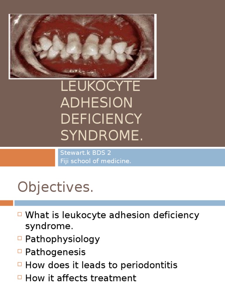 Leukocyte Adhesion Deficiency Syndrome Cell Adhesion White Blood Cell