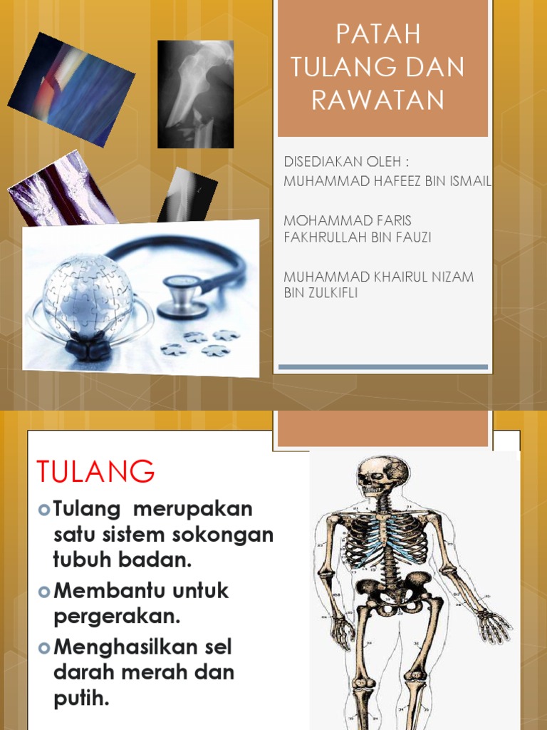 Patah Tulang Dan Rawatan Pdf