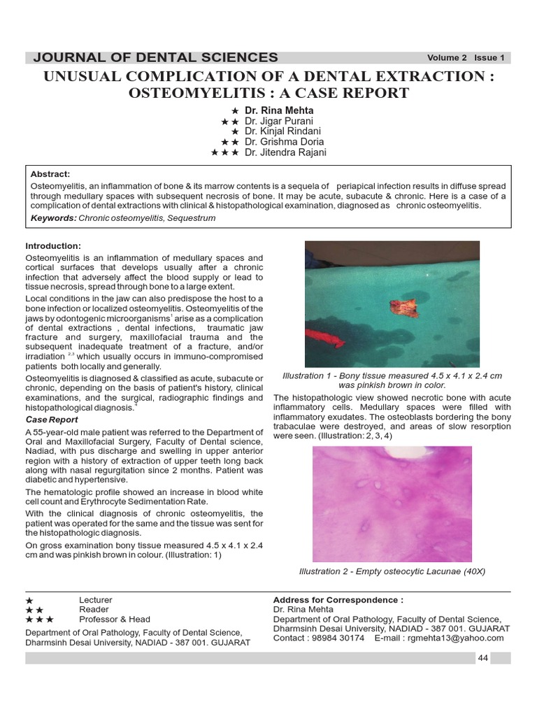 Unusual Complication of A Dental Extraction Osteomyelitis PDF