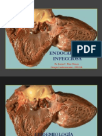 Endocarditis Infecciosa - Dr. Josías Ríos Ortega