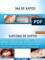 Sarcoma de Kaposi