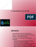 Aritmii - Generalitati, Aritmii SV