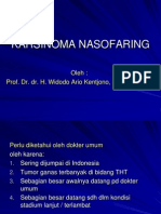 CA Nasofaring