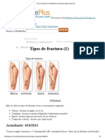 Tipos de Fractura (1) - MedlinePlus Enciclopedia Médica Illustración