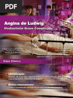 Angina de Ludwig