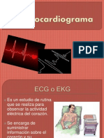 Electrocardiograma.pptx