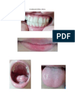 Gambar Intra Oral