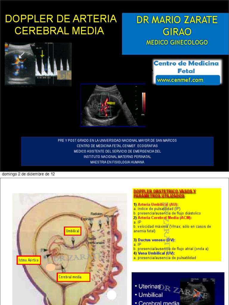 Doppler de Arteria Cerebral Media | PDF | Artería | Efecto Doppler