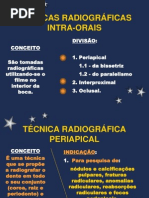 TÉCNICA RADIOGRÁFICA PERIAPICAL