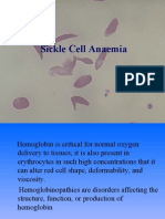 Sickle Cell Anaemia