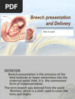 Breech