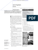 No Frills Guide to Epistaxis Management