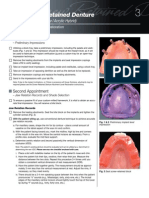 Screw Retained Implant Level