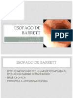 Esofago de Barrett