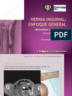 Hernia Inguinal