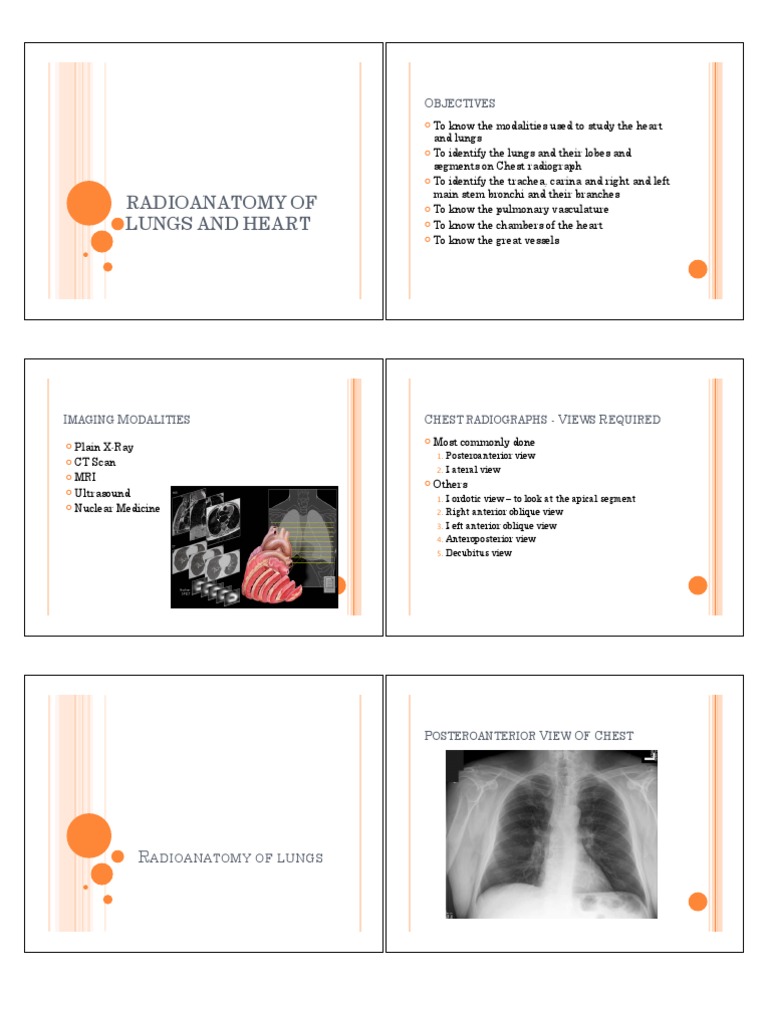 Radioanatomy of Lungs and Heart | PDF | Aorta | Coronary Circulation