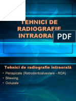 Tehnici radiografie intraorala