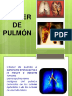 Trabajo Cancer de Pulmon