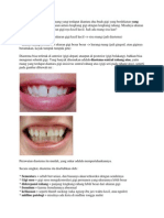 DIASTEMA