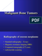 Malignant Bone Tumours 